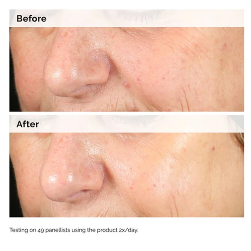 Альфа-арбутин 2% + HA 30 мл Сы – обзор и цена Alpha Arbutin Serum