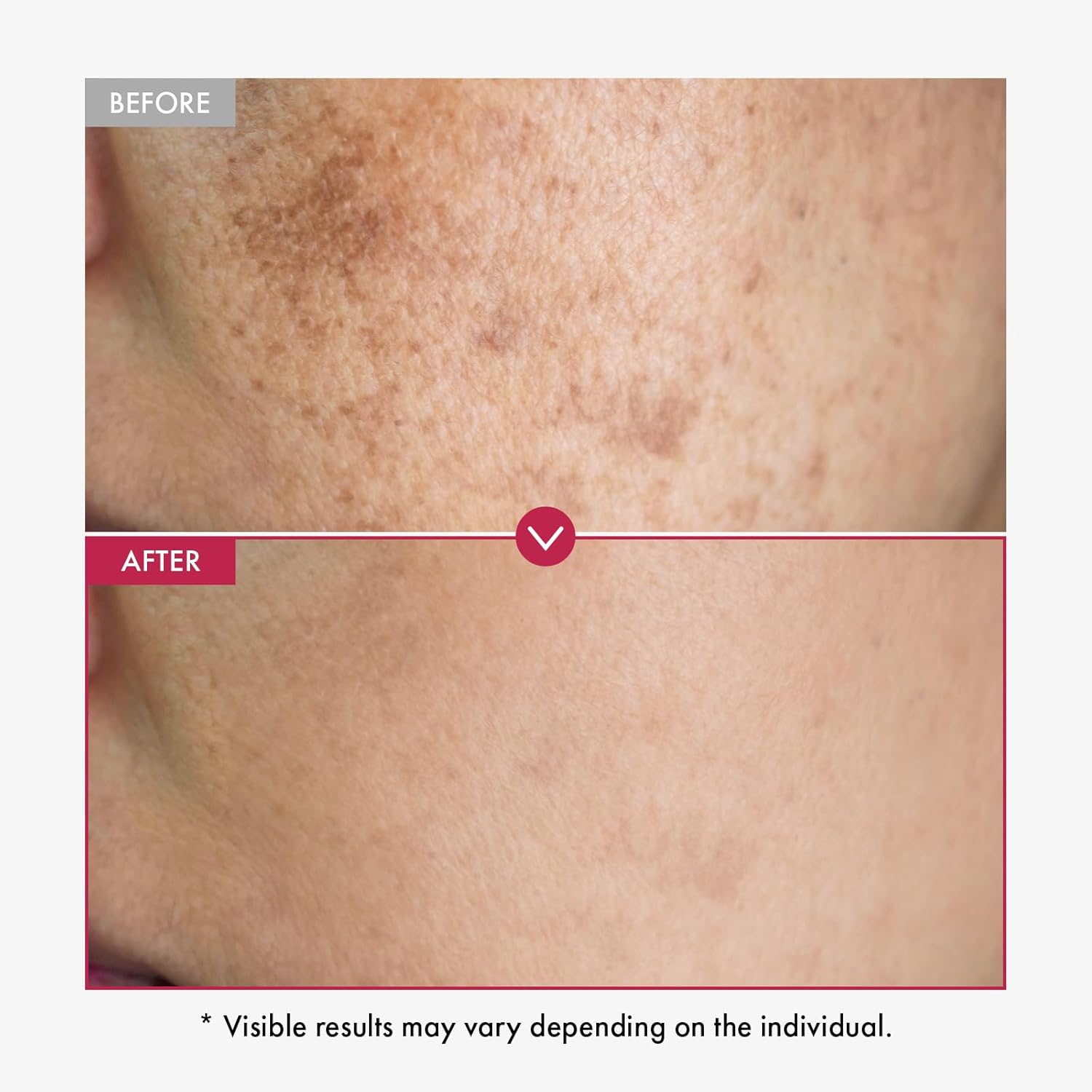 500 мл отбеливающая сыворотка  – обзор и цена Alpha Arbutin Serum